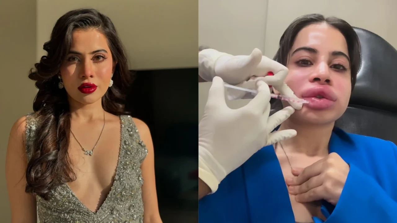 Uorfi Javed ने 9 साल बाद हटवाया लिप फिलर, दर्द में कराहती दिखीं; कहा- अब कराऊंगी नेचुरल ट्रीटमेंट